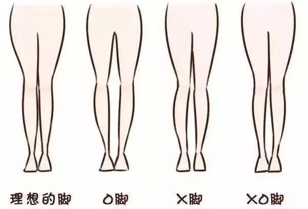 小粗腿、O型腿、X型腿？腿型矫正操拯救你的难看腿型!